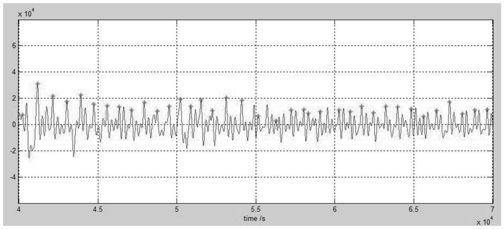 Error handling method for calculating hrv signal in human body impedance signal