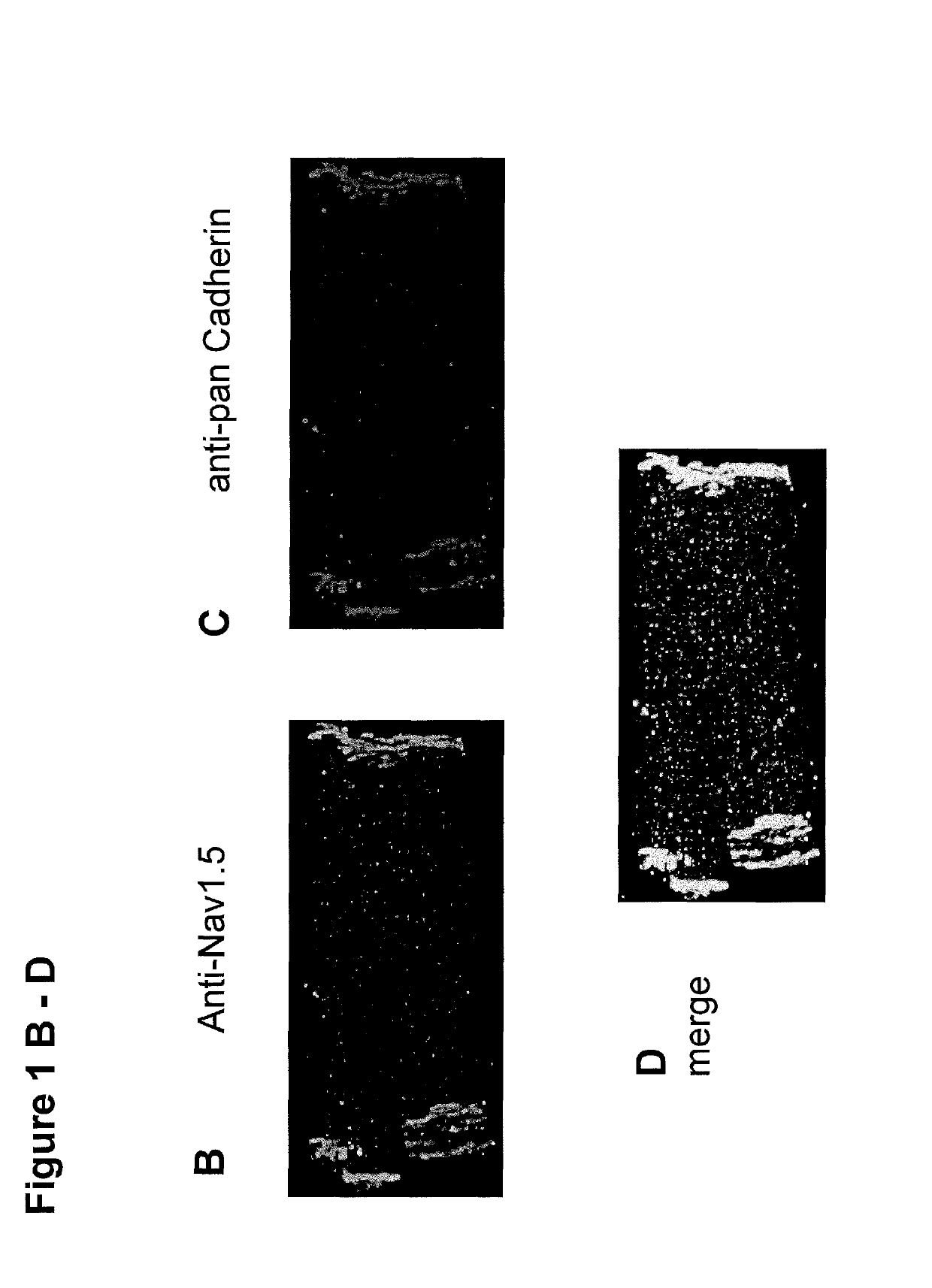 Method and kit for assessment of sodium channel-related anti- or pro-arrhythmic potential of compounds
