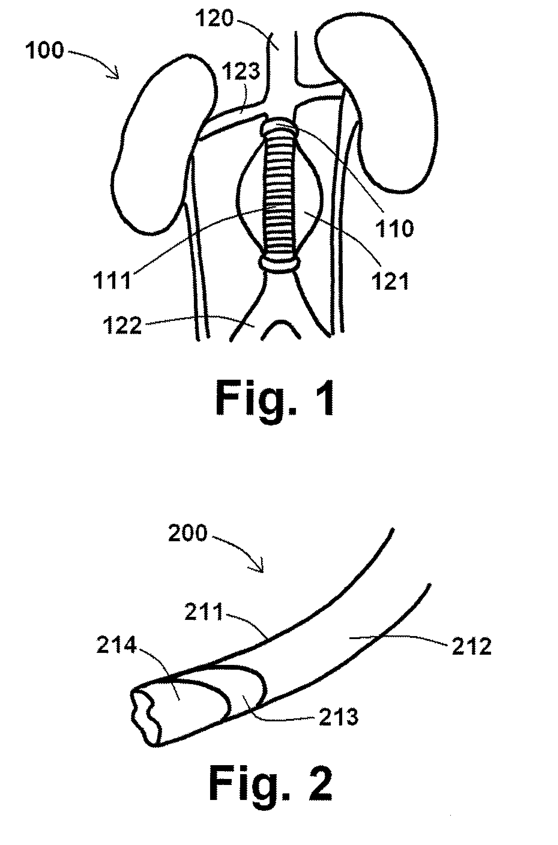 Endograft devices and methods to use the same