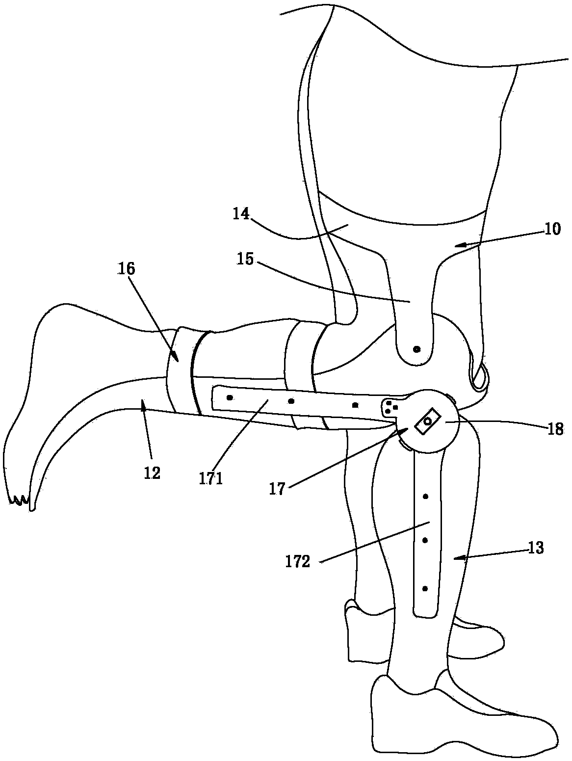 Temporary prosthesis after fracture