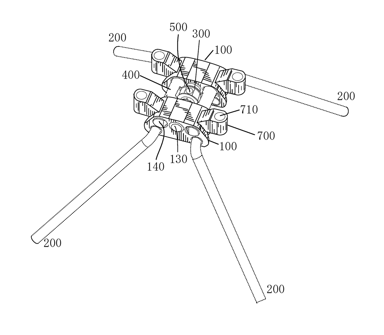 Maxillary skeletal expander device and method