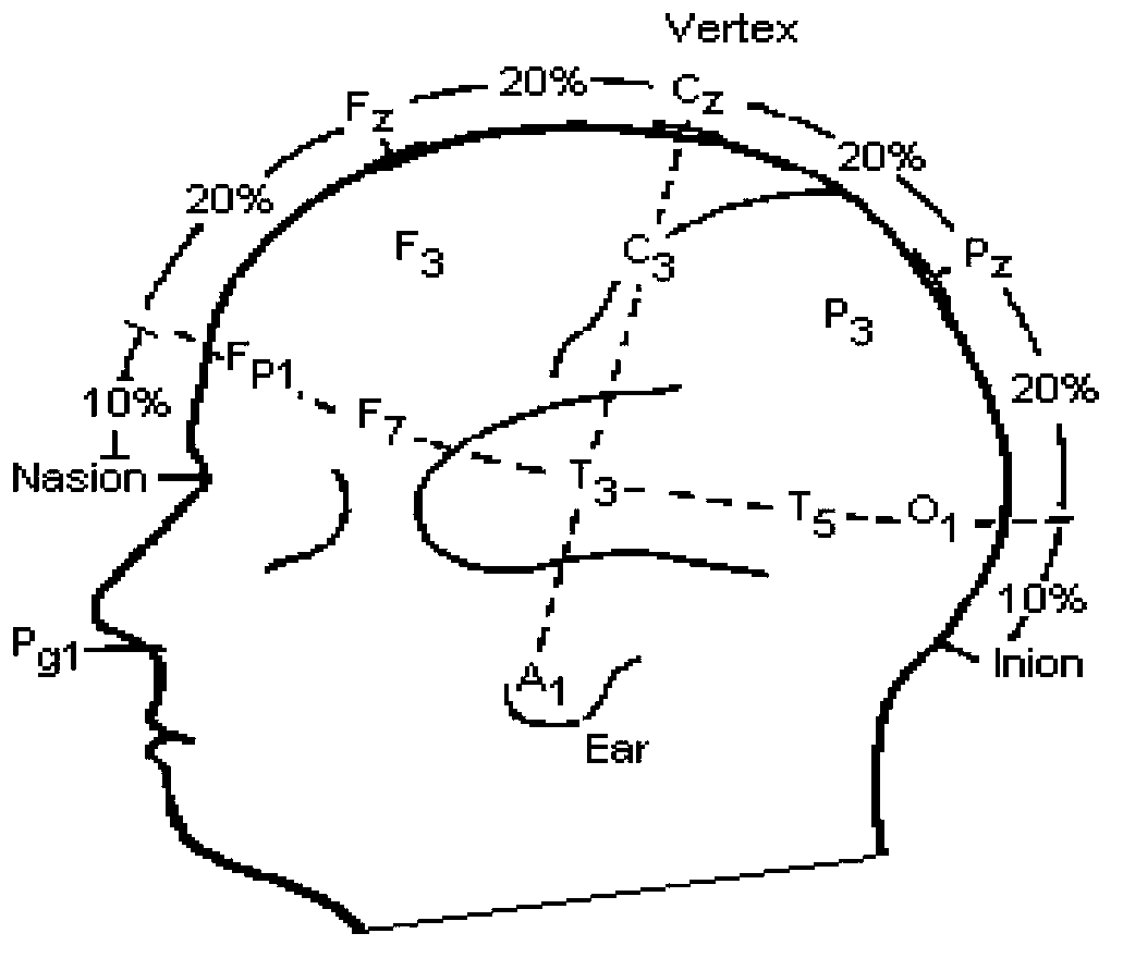 Method for extracting electroencephalogram characteristic based on quantitative electroencephalogram