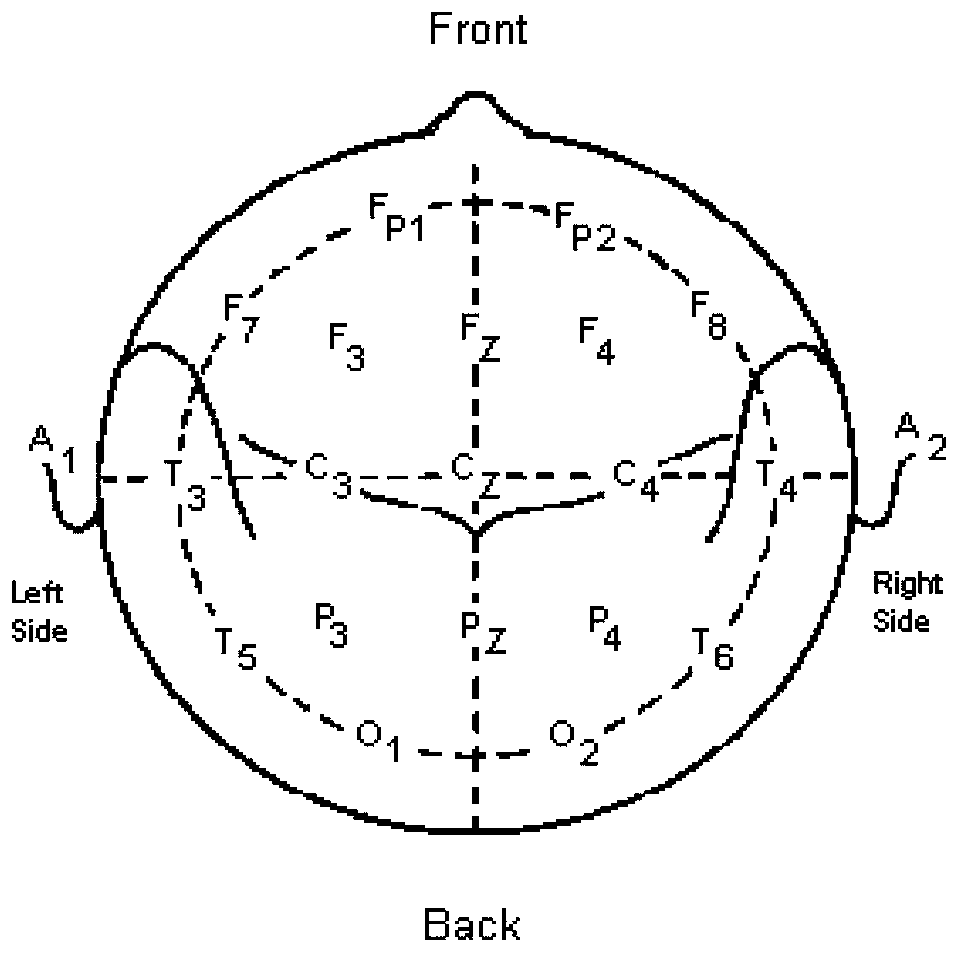 Method for extracting electroencephalogram characteristic based on quantitative electroencephalogram