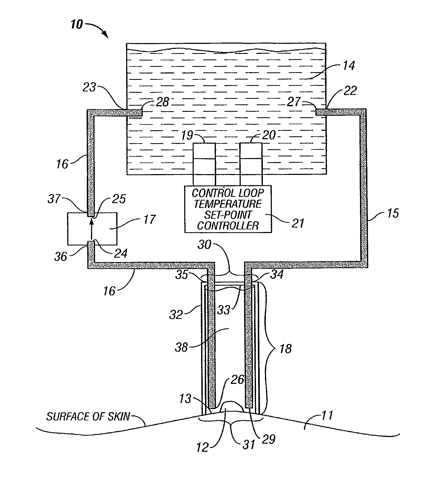 Localized liquid therapy and thermotherapy device