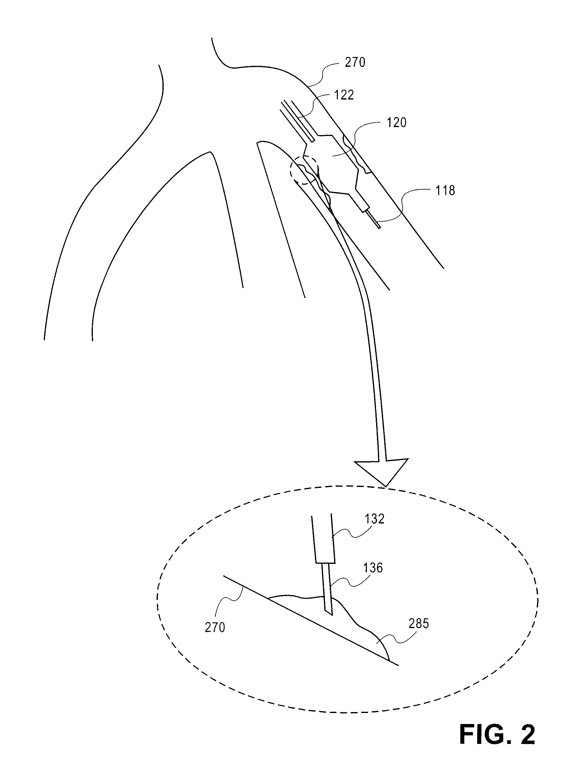 Sustained release of Apo A-I mimetic peptides and methods of treatment