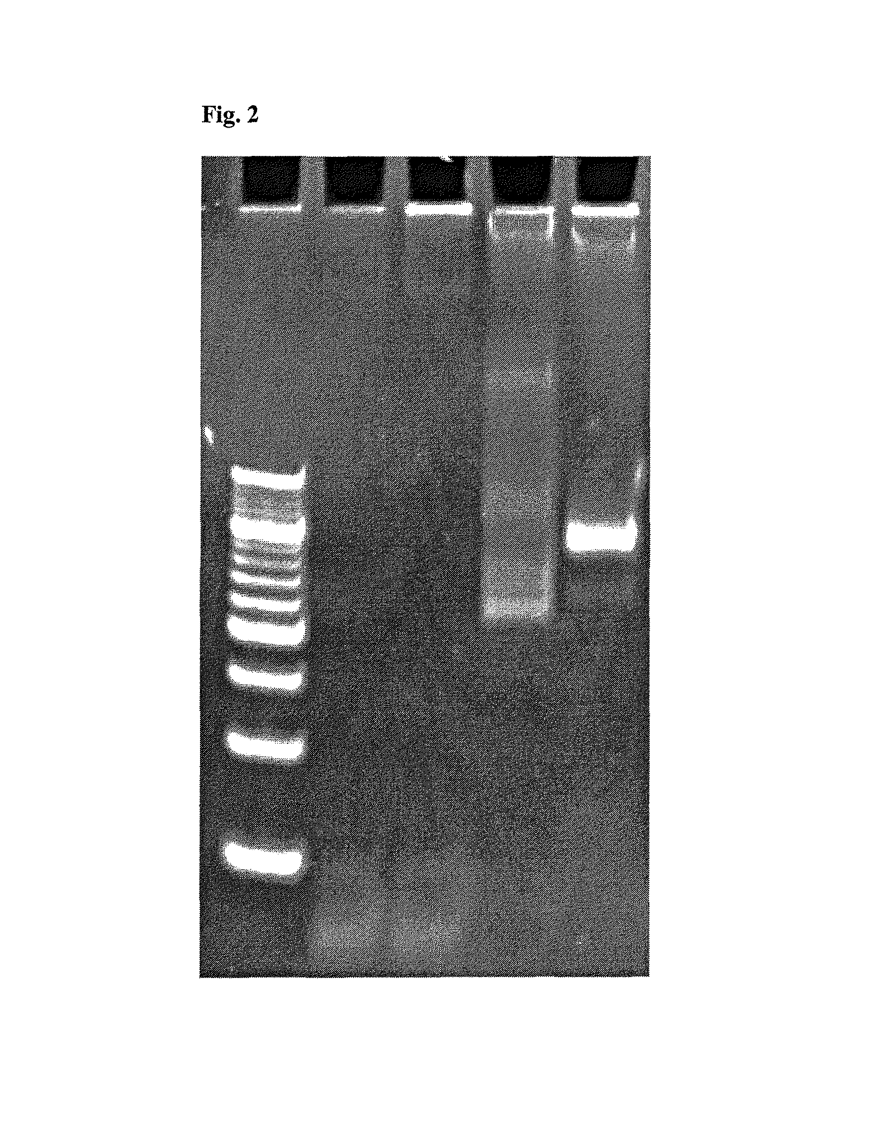 Method for detecting and/or quantifying human DNA