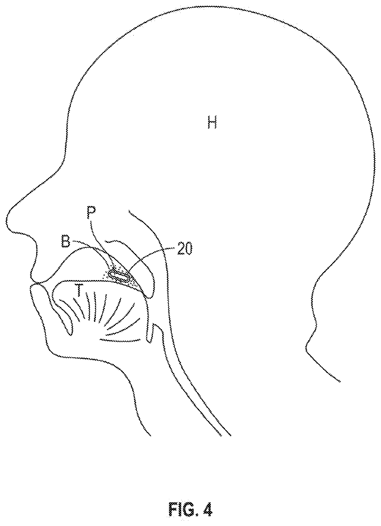 Avoiding gag reflex to enable swallowing pills