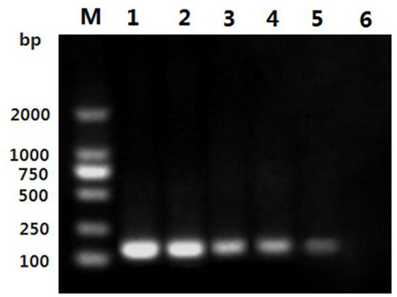 A pcr primer targeting 5`-utr gene to detect goose parvovirus with short beak dwarf syndrome