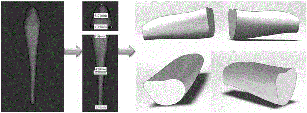 Preparation method of artificial finger joint prosthesis