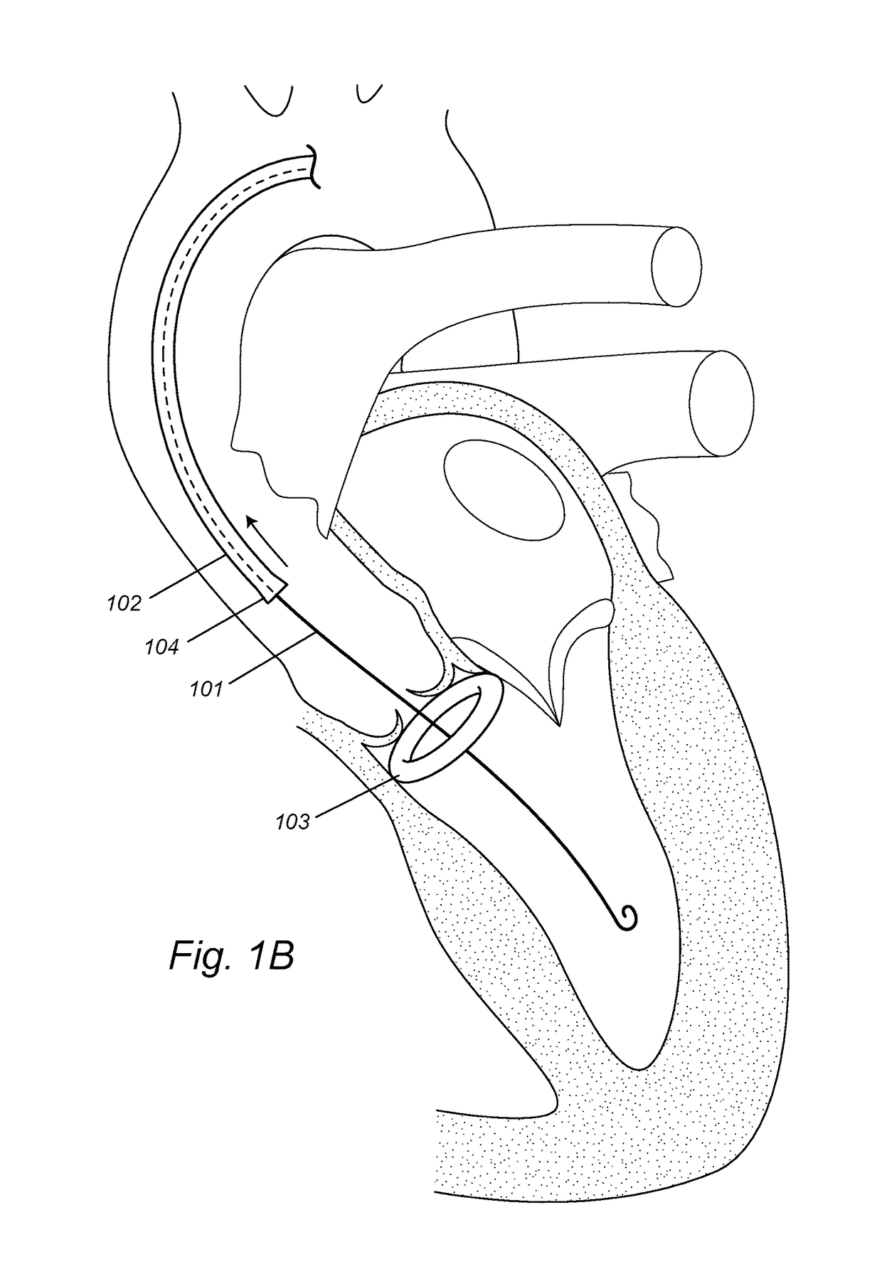 Devices, systems, and methods to optimize annular orientation of transcatheter valves