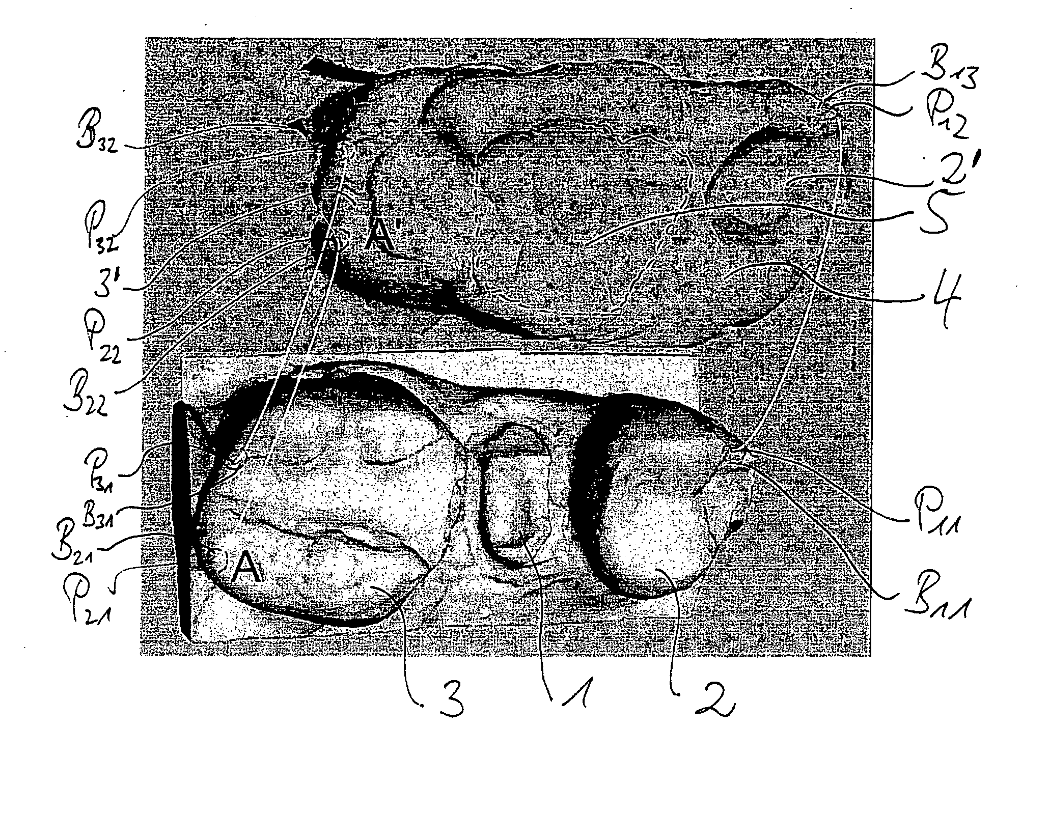 Method for obtaining a position match of 3D data sets in a dental CAD/CAM system