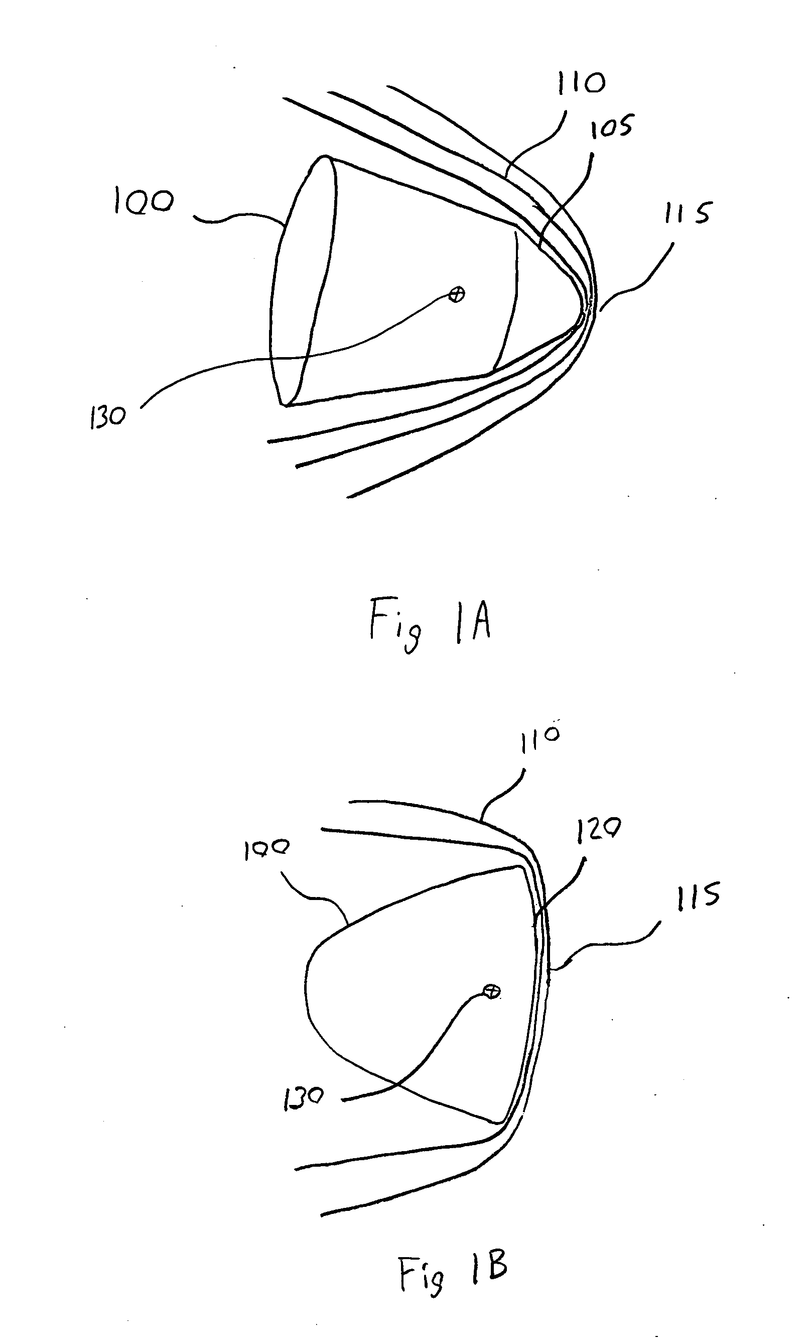 Atmospheric entry thermal protection system