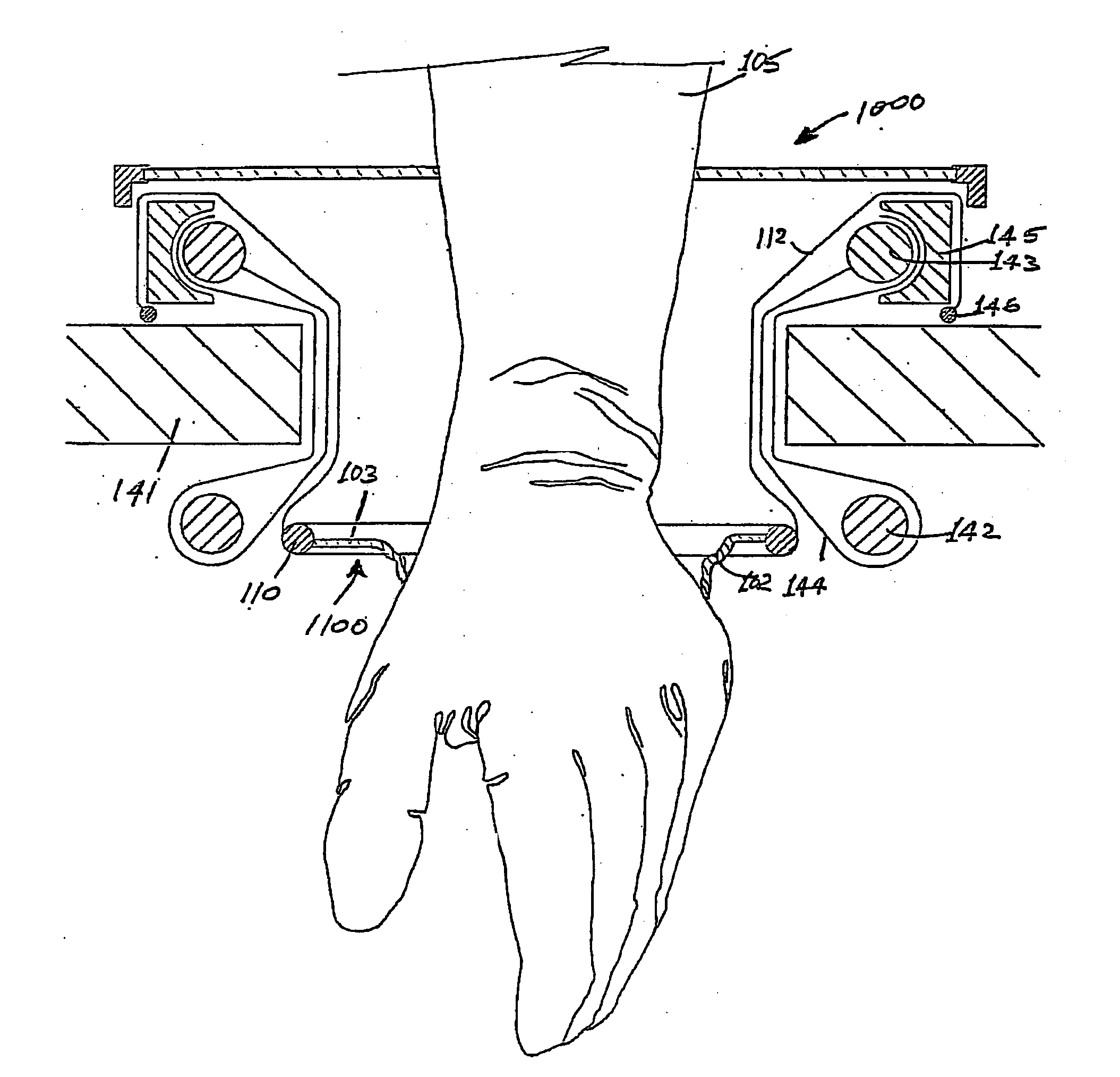 A surgical sealing device