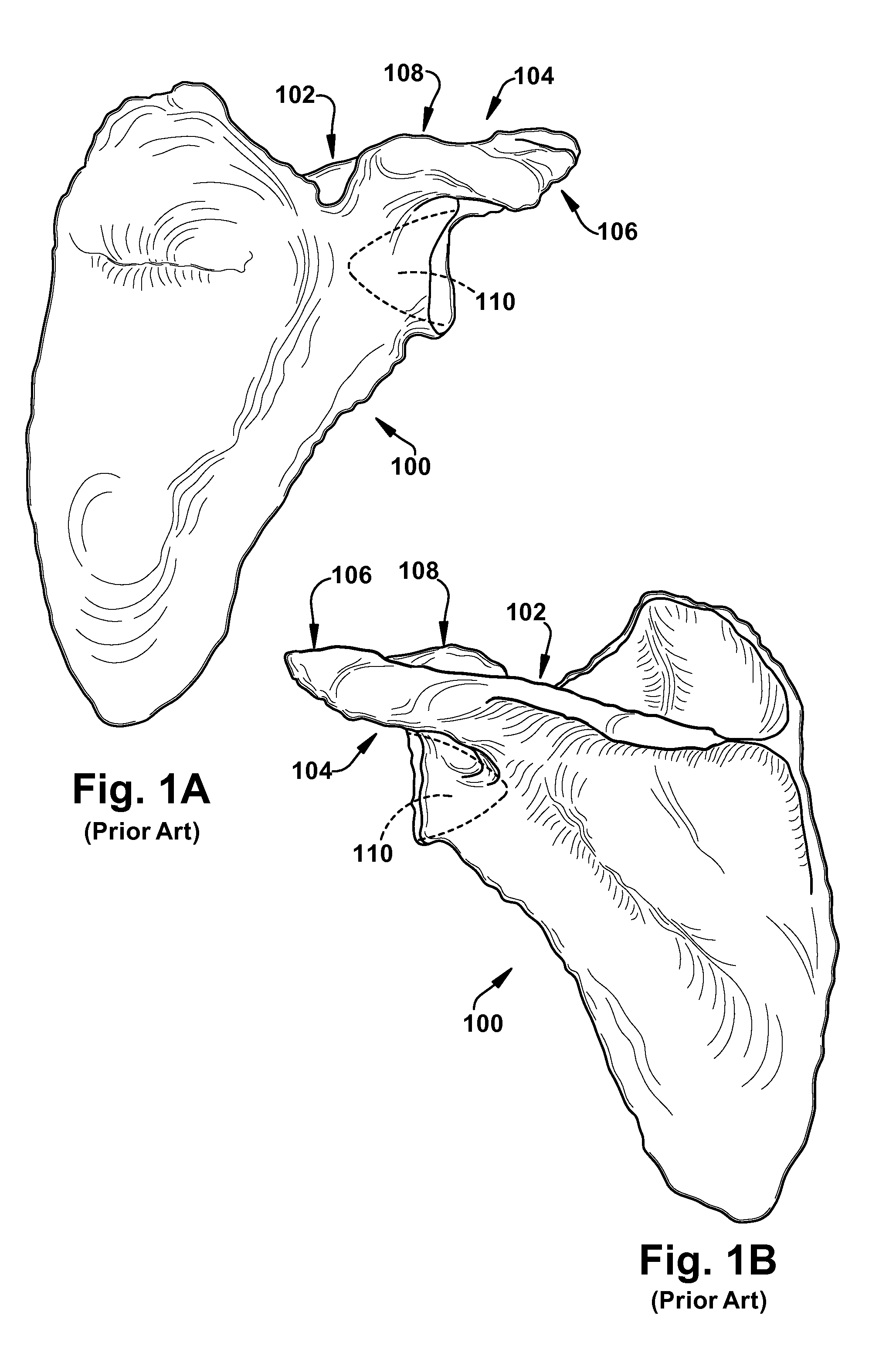 System of preoperative planning and provision of patient-specific surgical aids