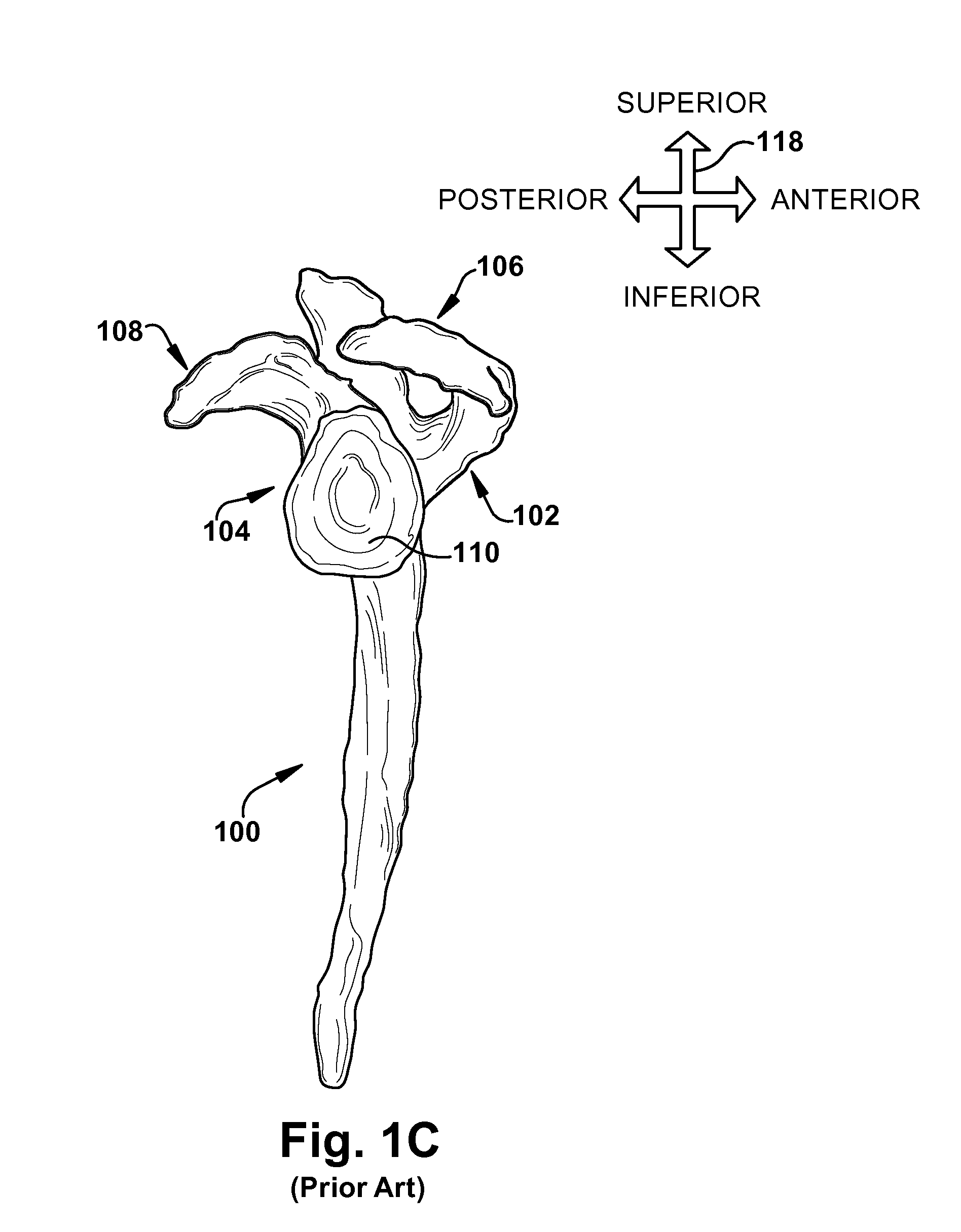 System of preoperative planning and provision of patient-specific surgical aids