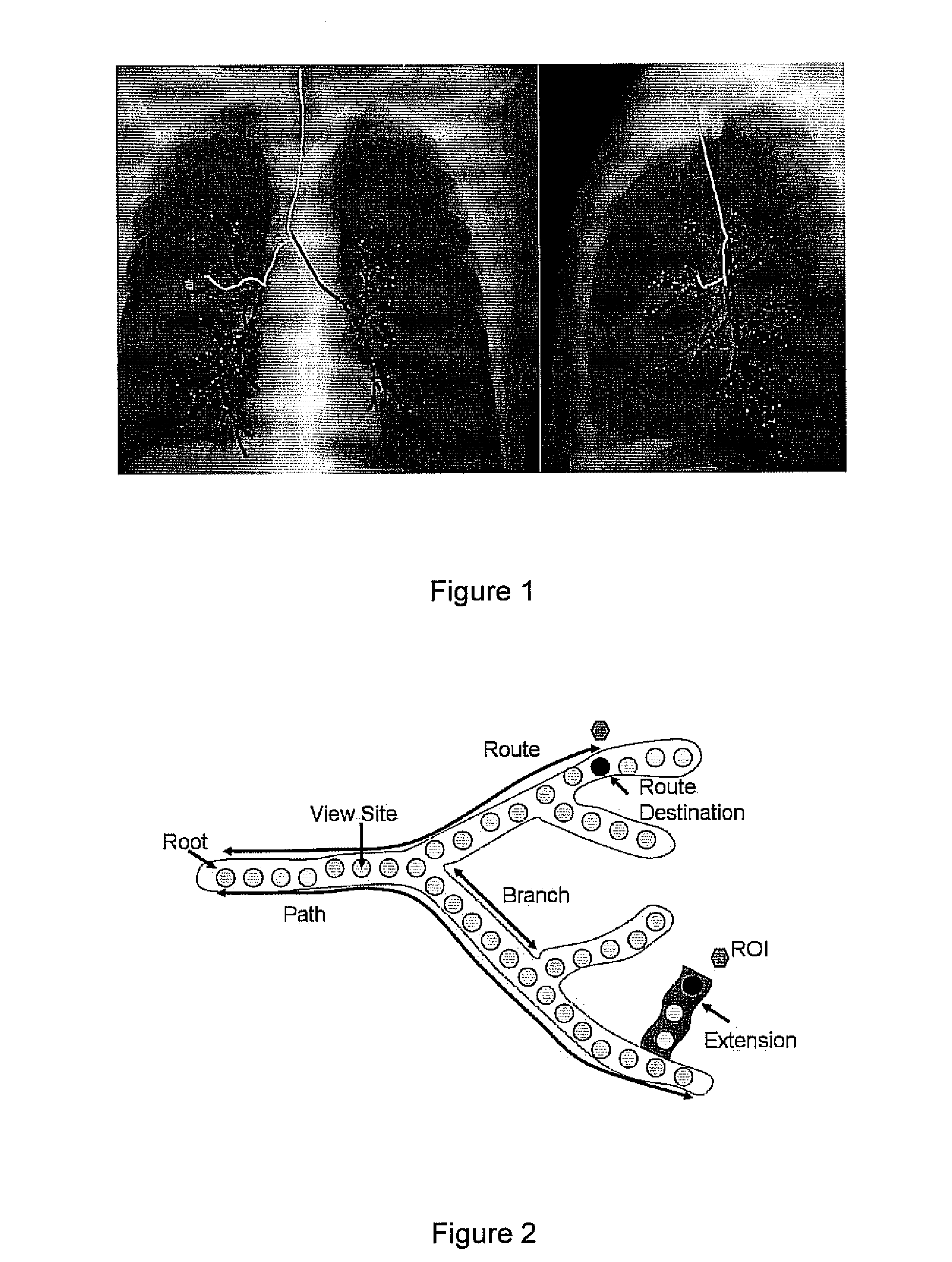 Methods and apparatus for 3D route planning through hollow organs