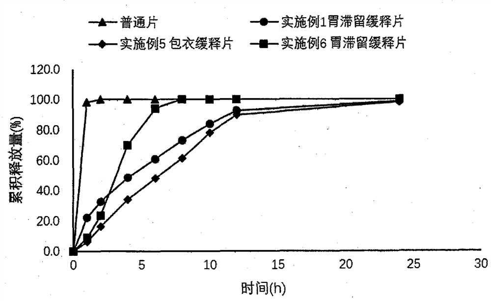 Dexketoprofen Tromethamine Sustained Release Tablets for Gastric Retention