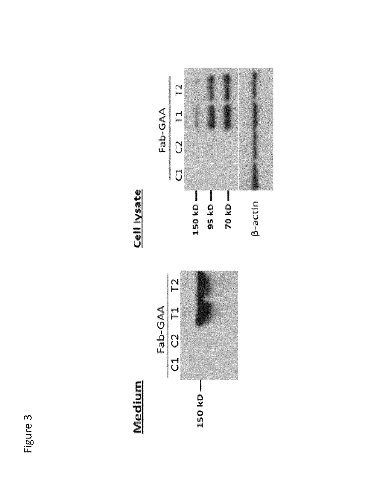 Methods and compositions for treatment of glycogen storage diseases and glycogen metabolism disorders
