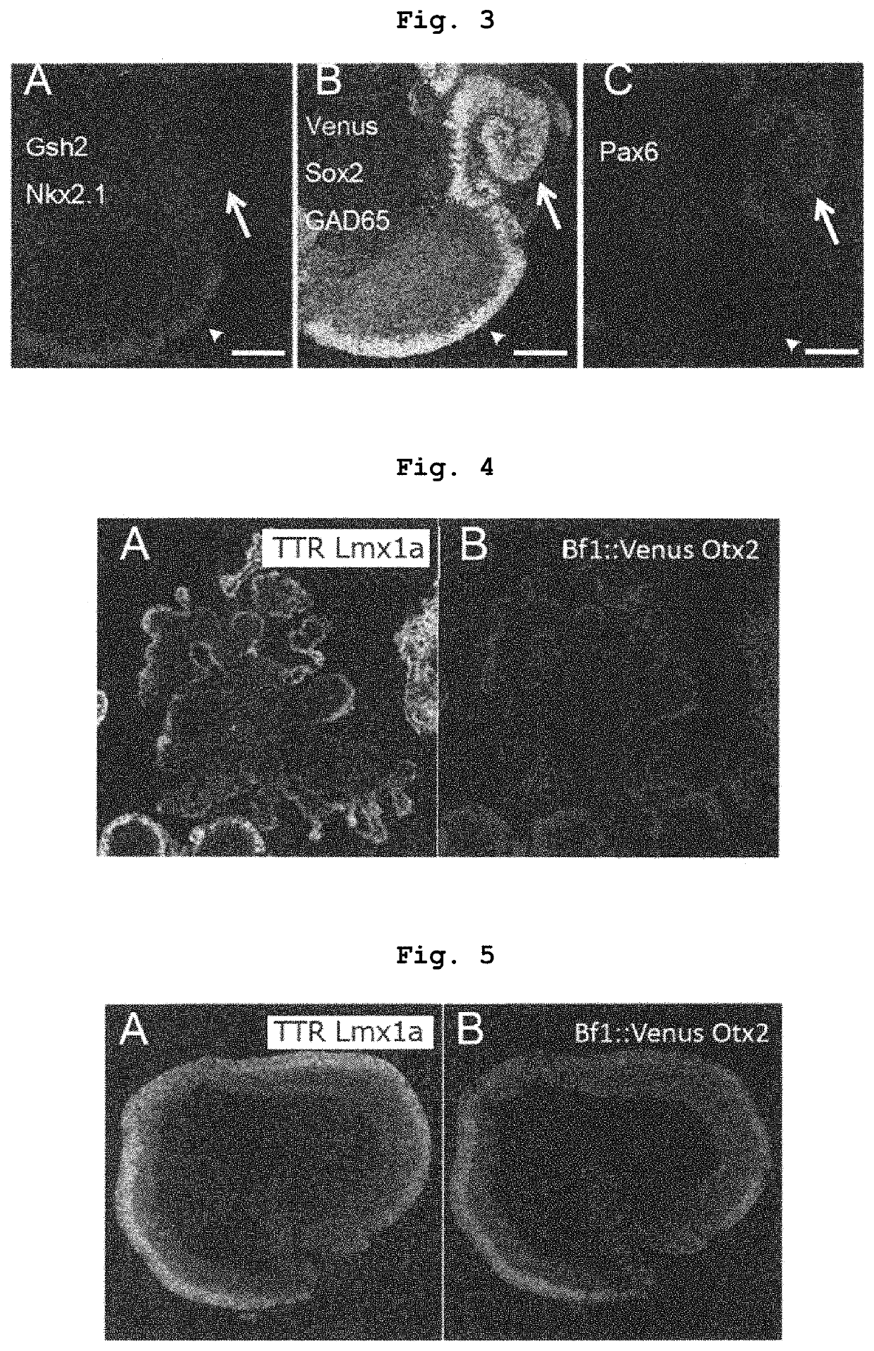 Method for manufacturing telencephalon or progenitor tissue thereof