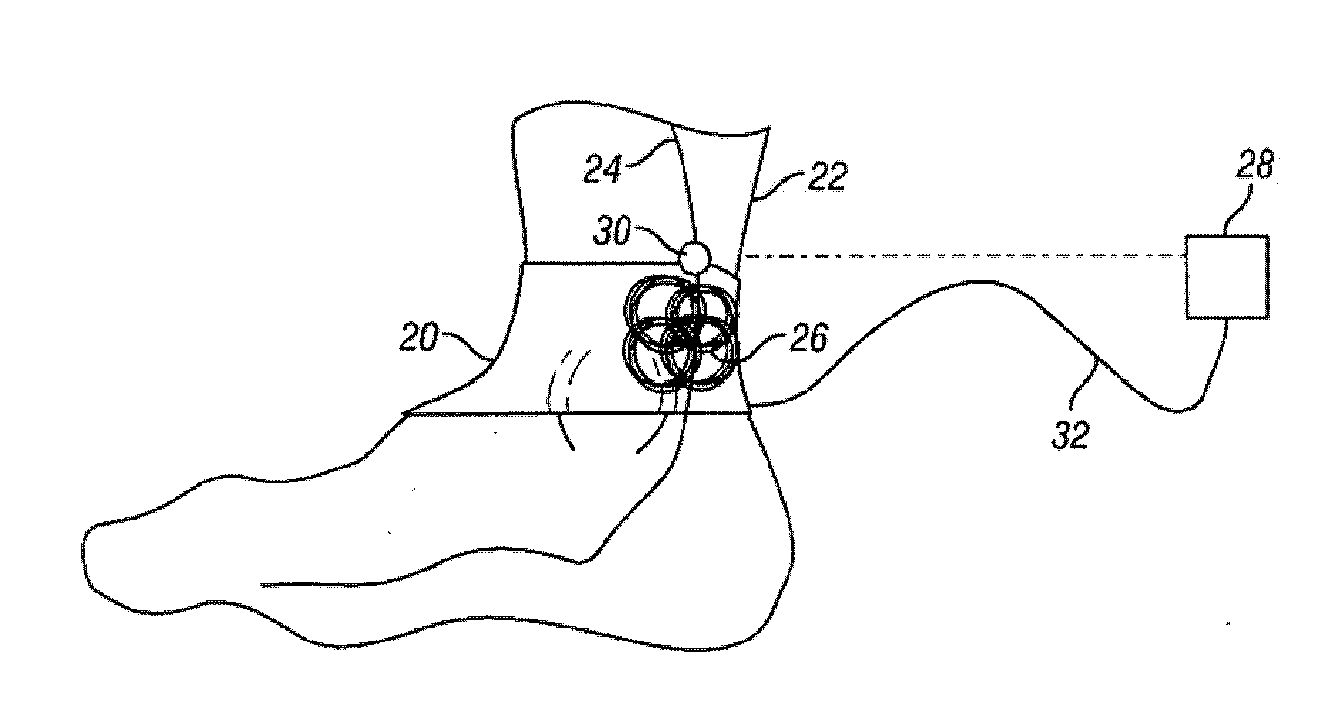 Method and apparatus for magnetic induction therapy