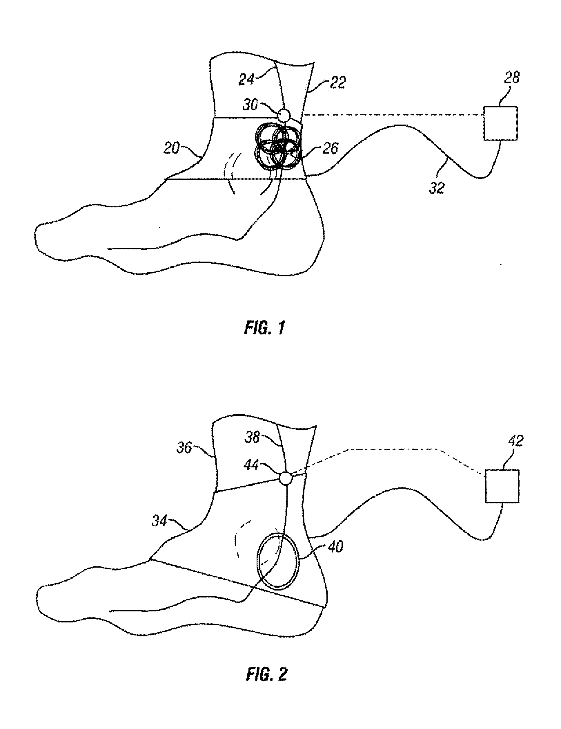 Method and apparatus for magnetic induction therapy