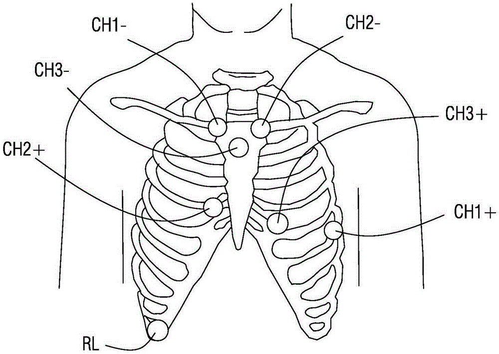 Electrocardio-electrode position monitoring method