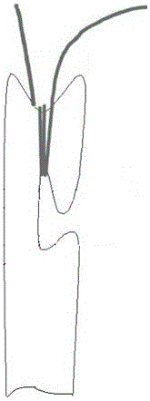 Threading-free hand sewing needle and use method thereof