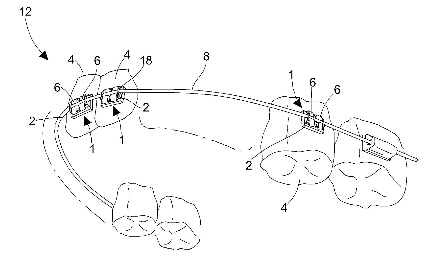 Dento-facial orthopedic treatment and orthodontic arch wire for implementing the same