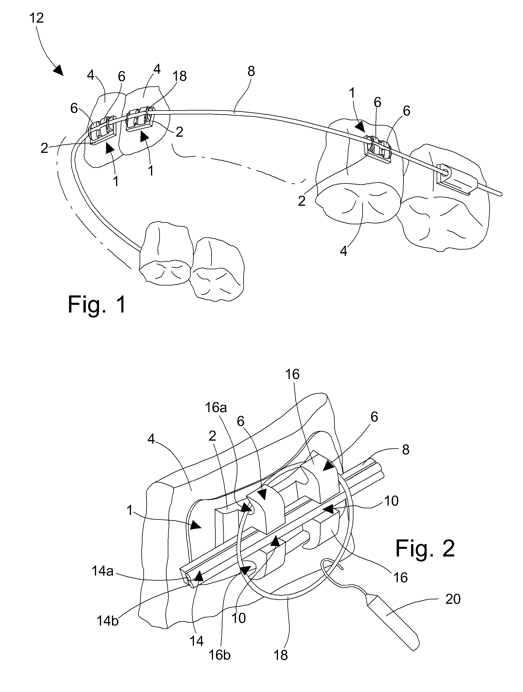 Dento-facial orthopedic treatment and orthodontic arch wire for implementing the same