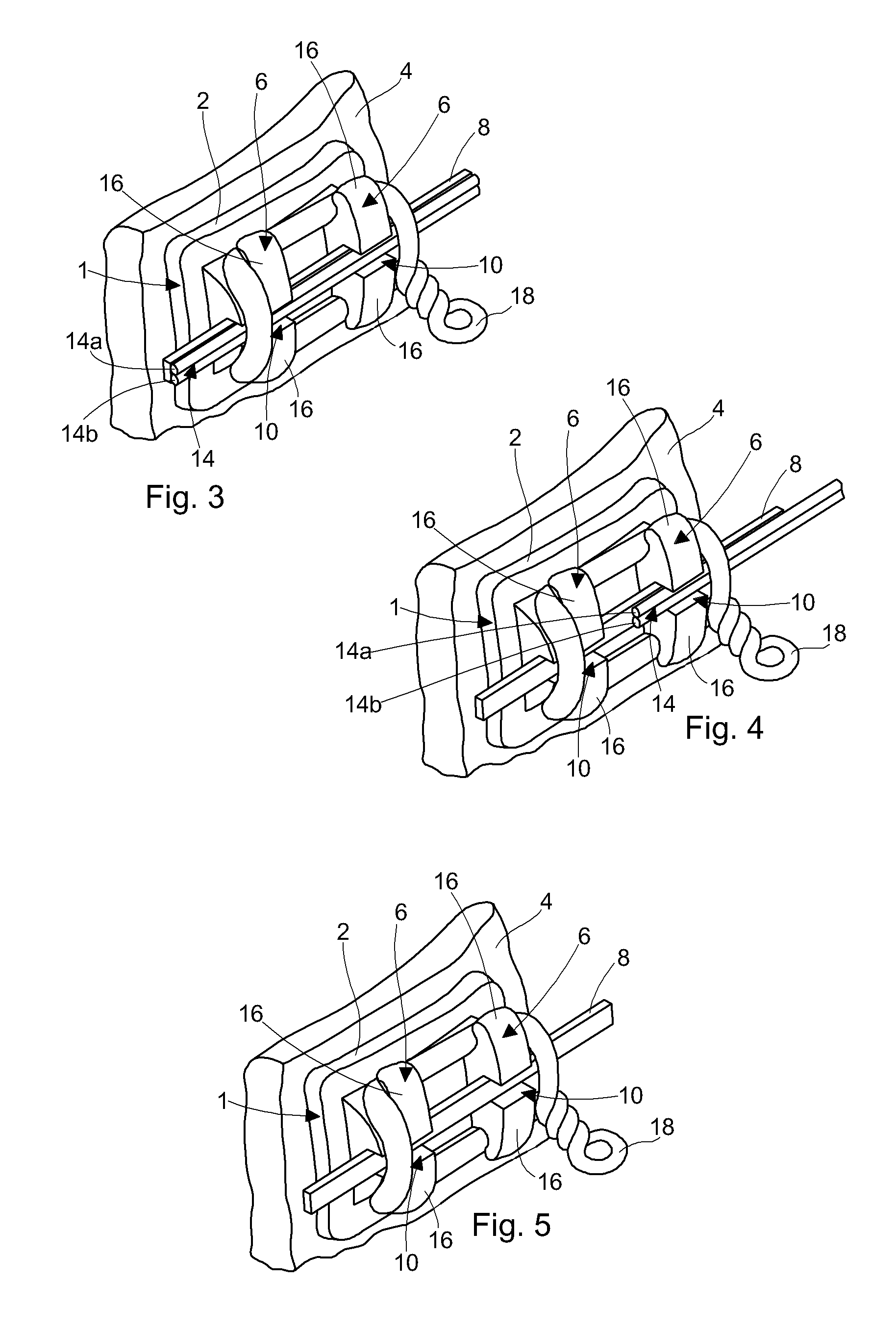 Dento-facial orthopedic treatment and orthodontic arch wire for implementing the same