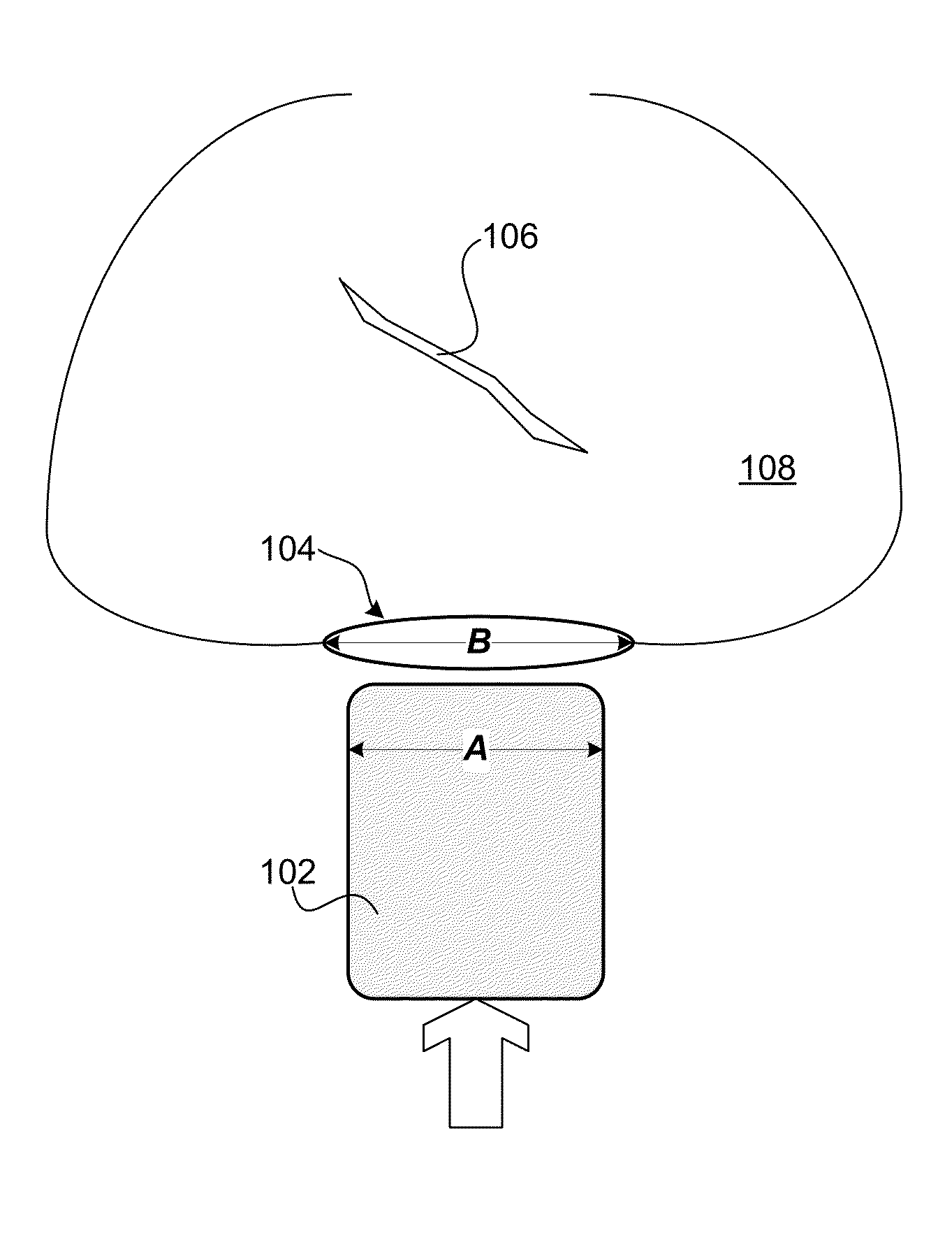 Expandable Surgical Implant Device