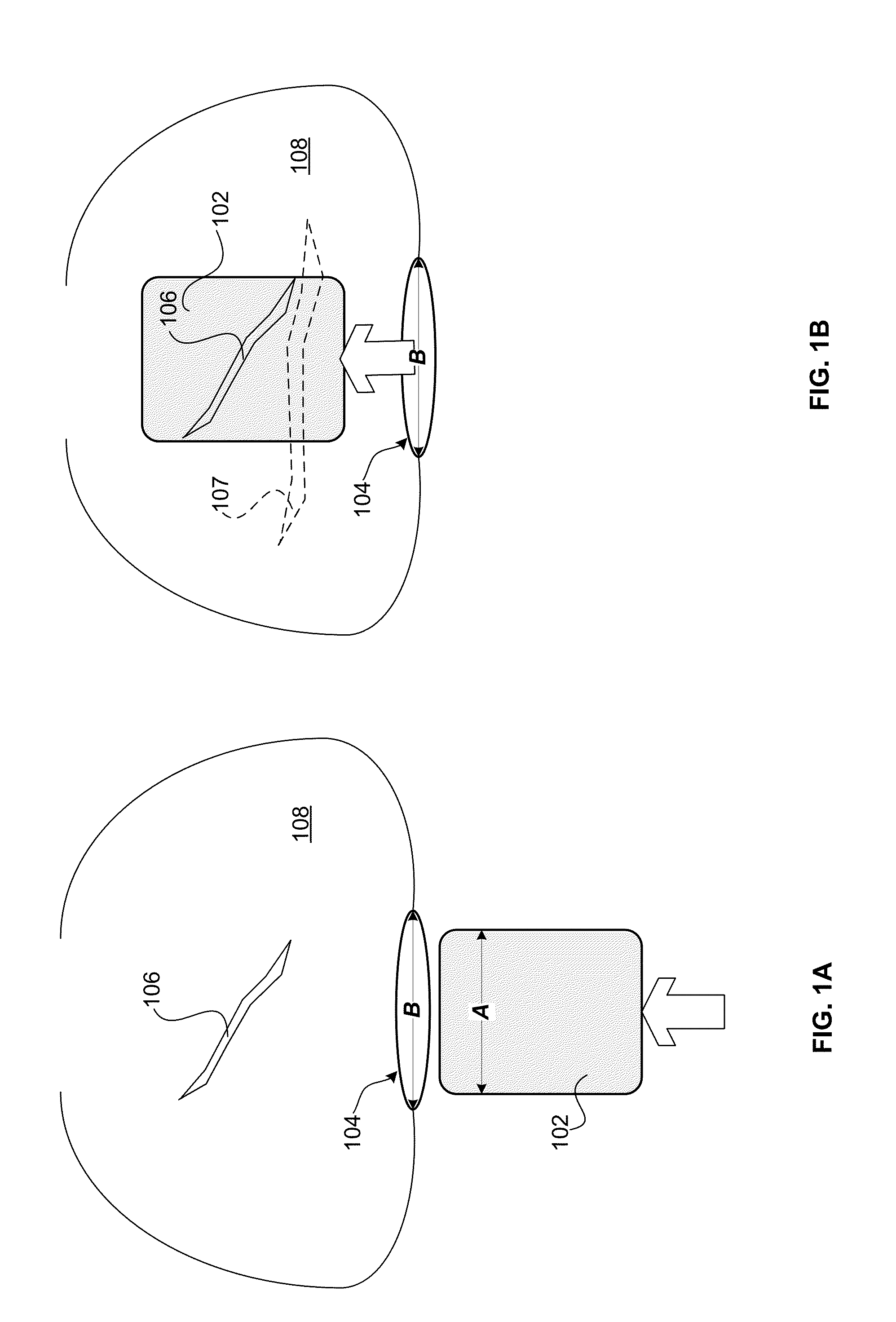 Expandable Surgical Implant Device