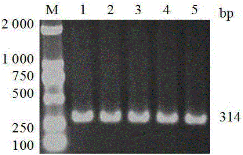 Primer pair for detecting enzootic nasal tumor virus gene and application of primer pair