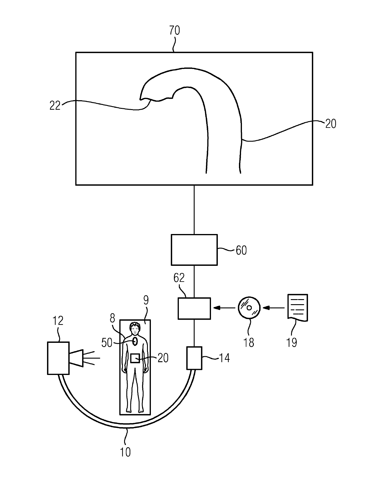 Method and X-ray device for temporal up-to-date representation of a moving section of a body, computer program product and data carrier