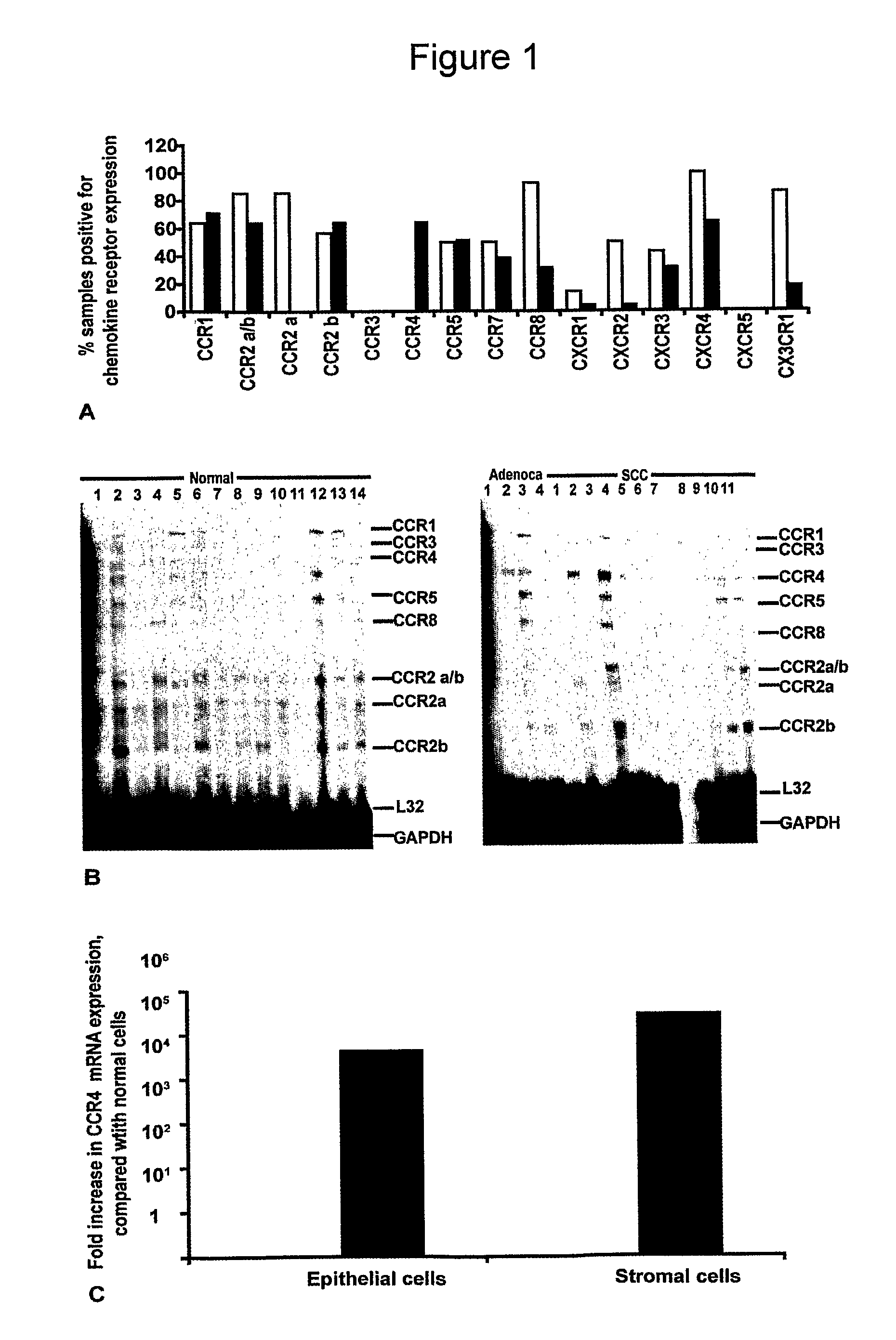 Cancer marker and therapeutic target