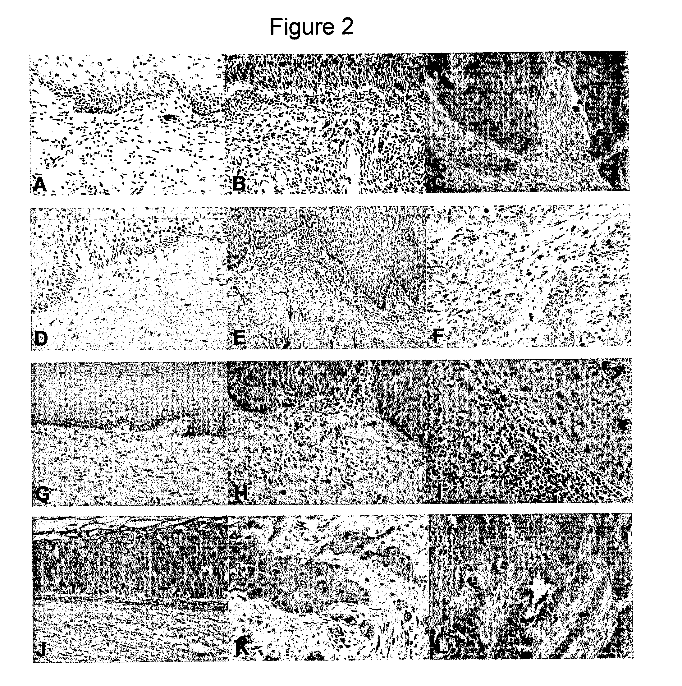 Cancer marker and therapeutic target