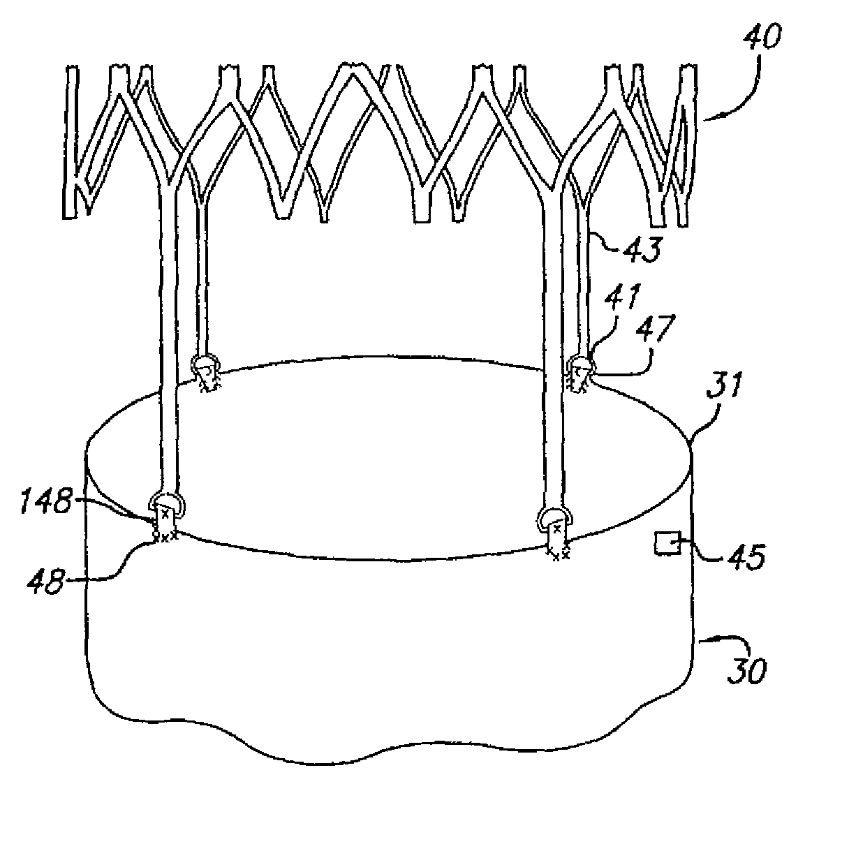 Endovascular graft device and methods for attaching components thereof