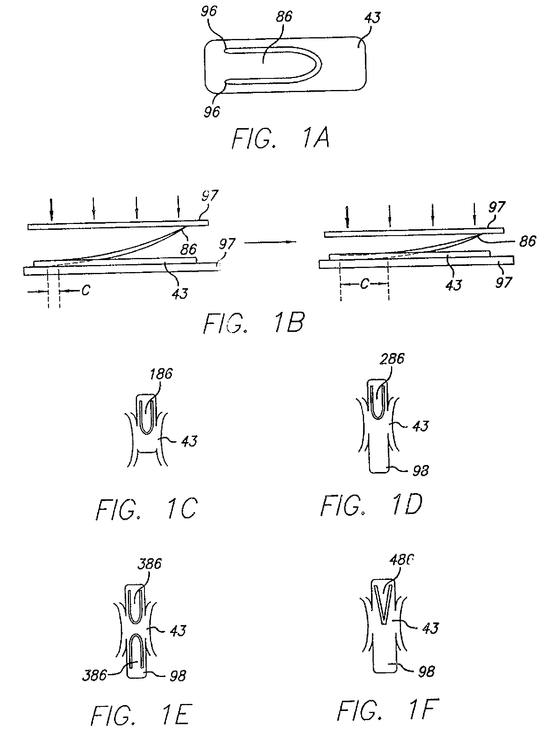 Endovascular graft device and methods for attaching components thereof