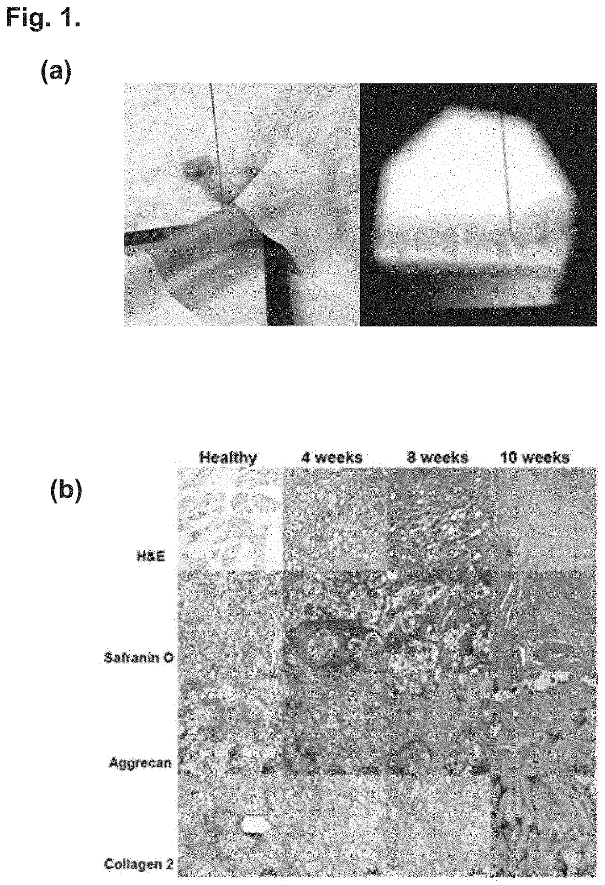 Compositions and methods for degenerative disc regeneration