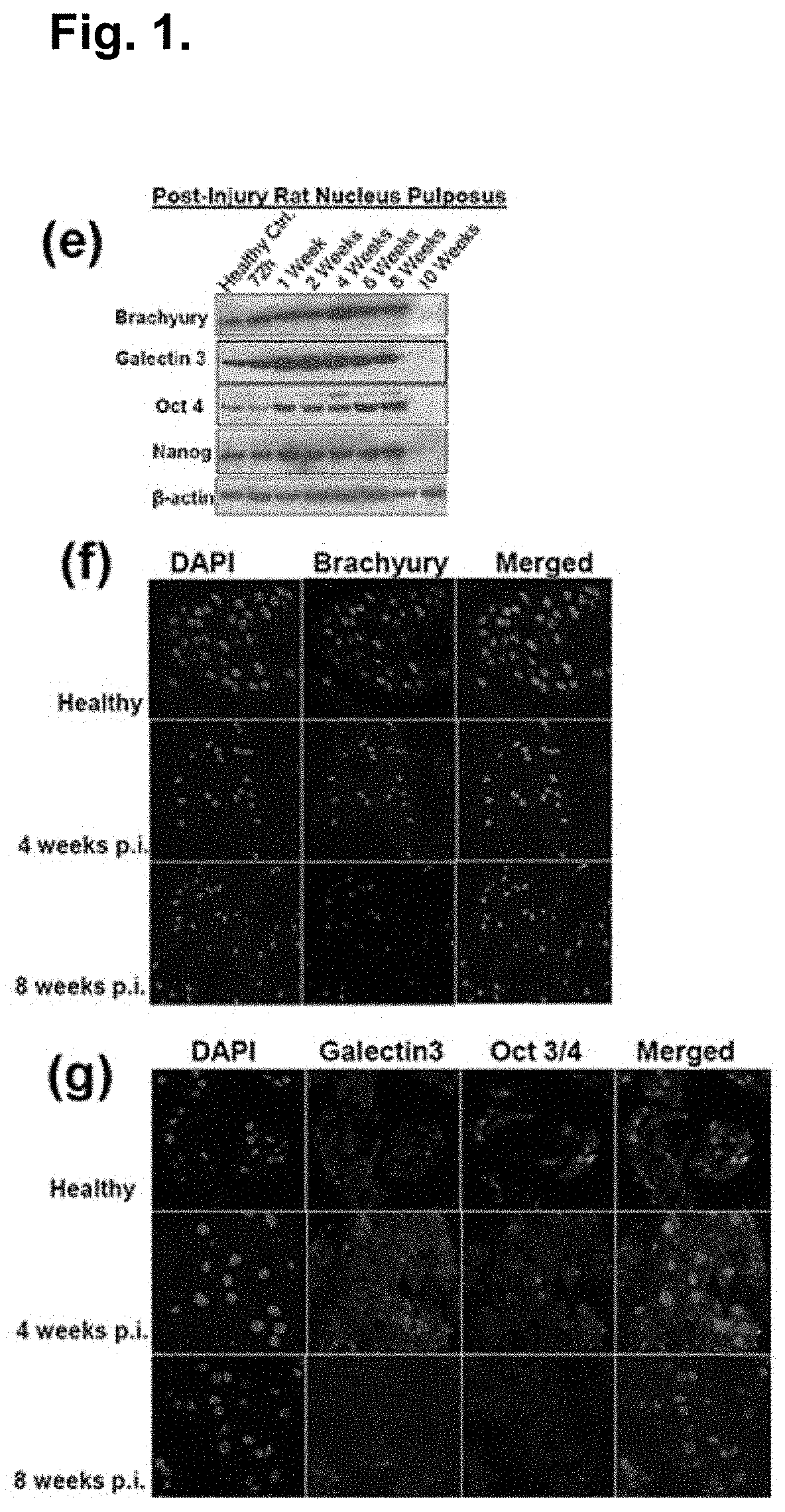 Compositions and methods for degenerative disc regeneration