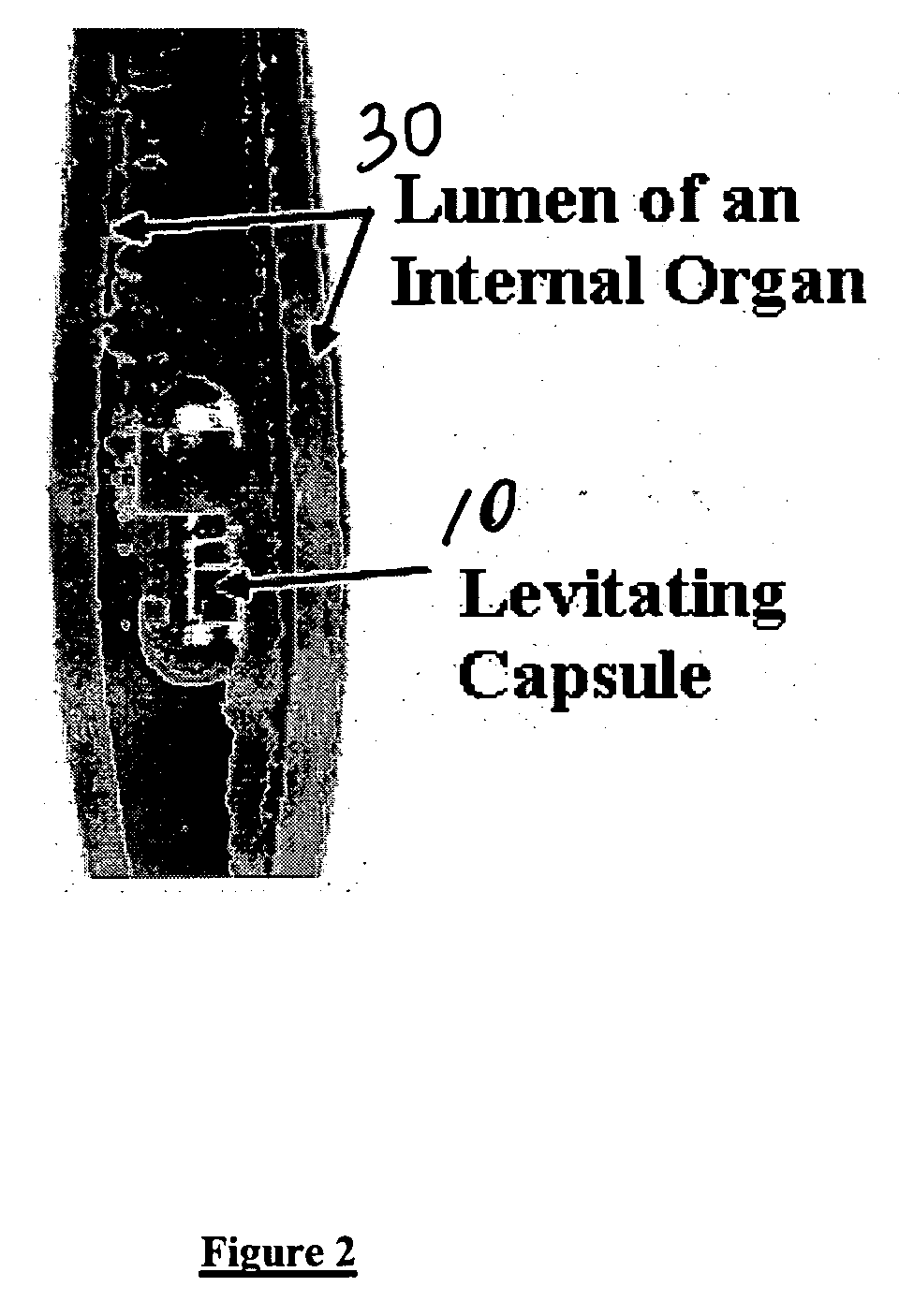 Magnetic levitation of intraluminal microelectronic capsule
