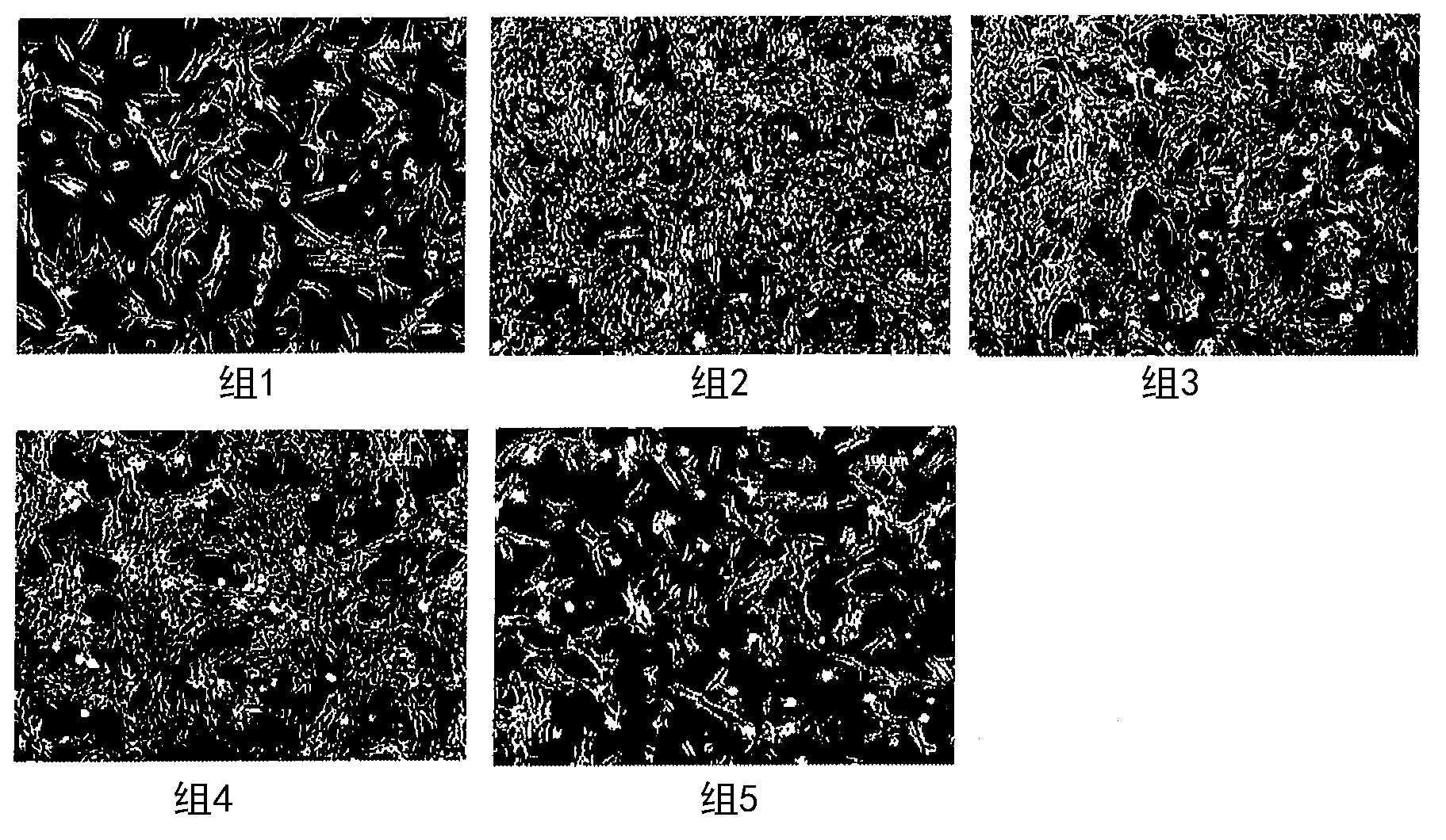 Culture medium composition for culturing amnion-derived mesenchymal stem cell, and method for culturing amnion-derived mesenchymal stem cell by using same