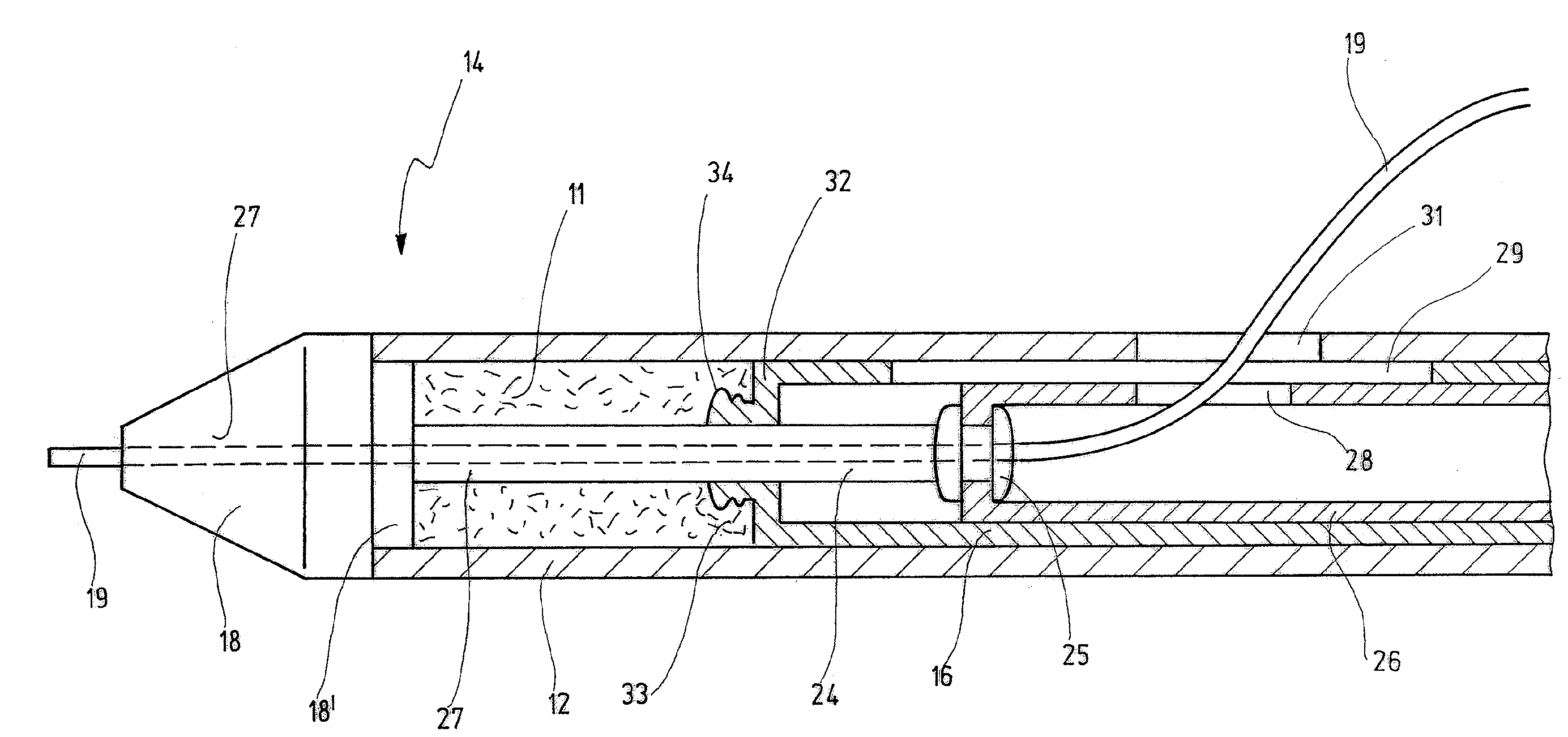 Delivery system having a self-expanding braided stent