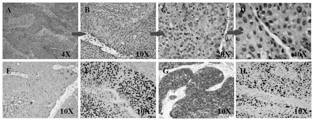 A kind of cervical cancer tumor primary cell separation and culture method