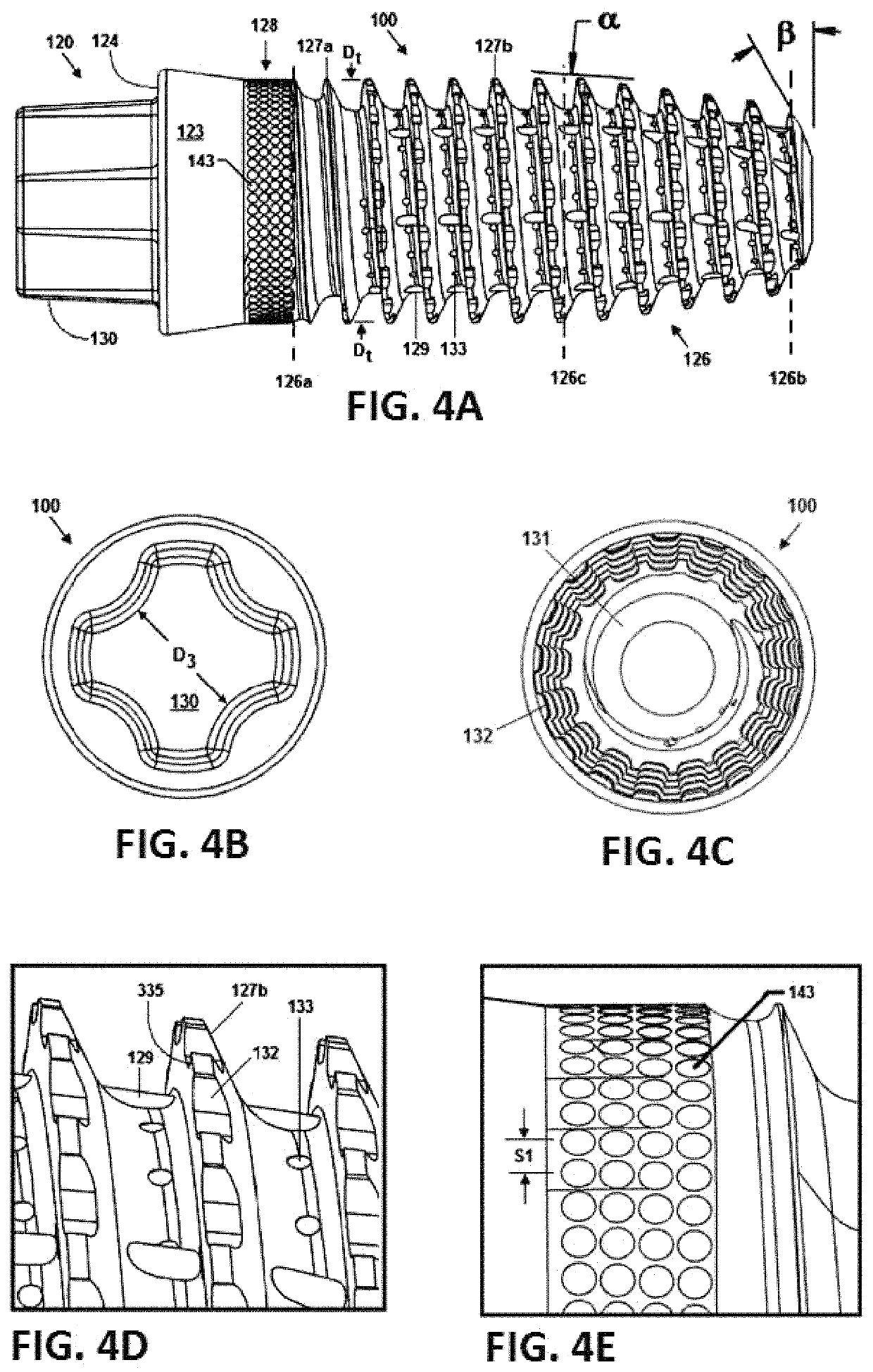 Osseointegrative surgical implant