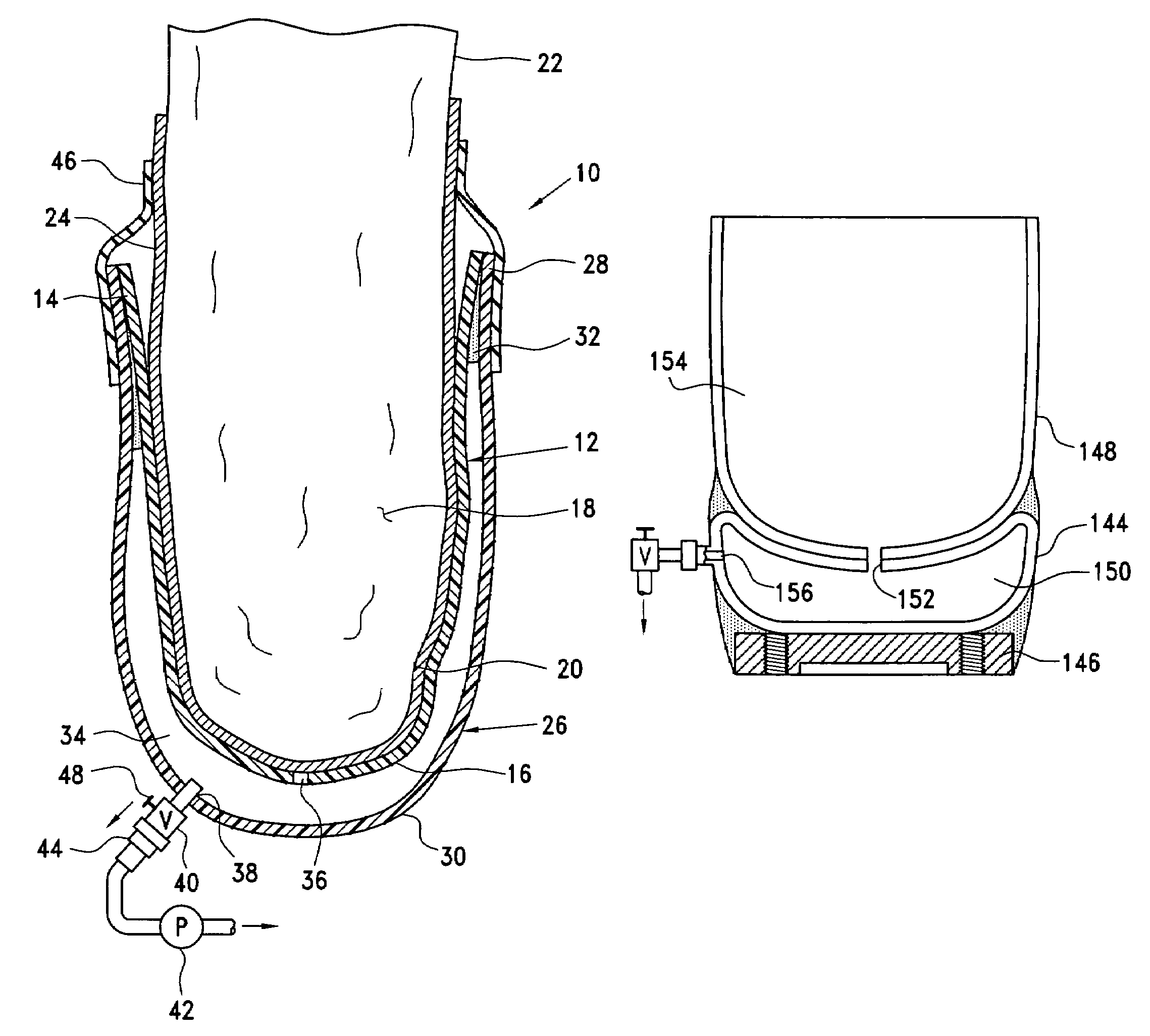 Prosthetic socket with self-contained vacuum reservoir