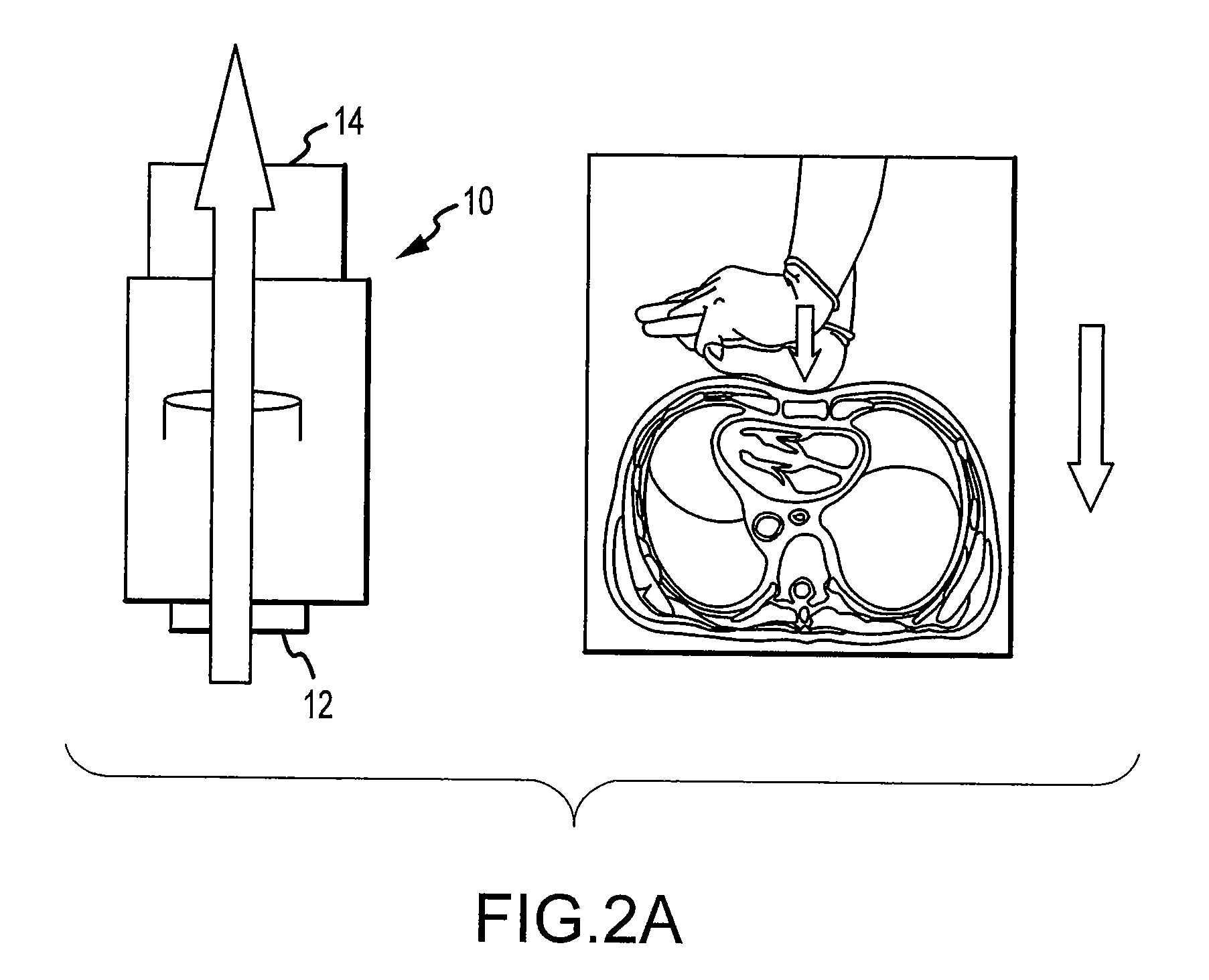 Volume exchanger valve system and method to increase circulation during cpr