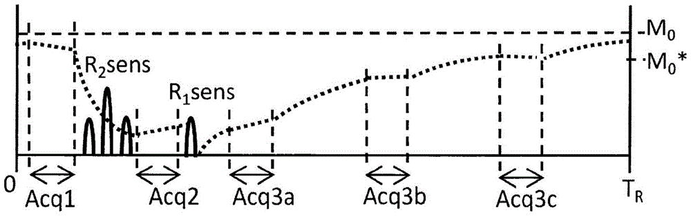 Improved method and system for magnetic resonance acquisition