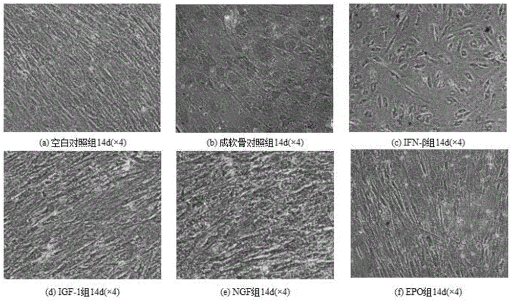 A kind of personalized bone repair material and its preparation method