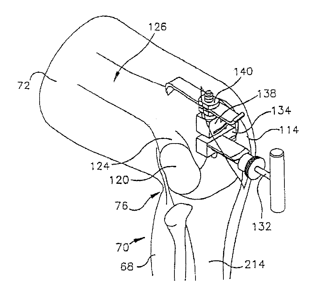 Minimally Invasive Surgical Systems and Methods